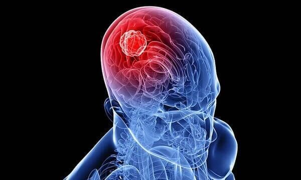  DR. JOSE LUIS PISANO