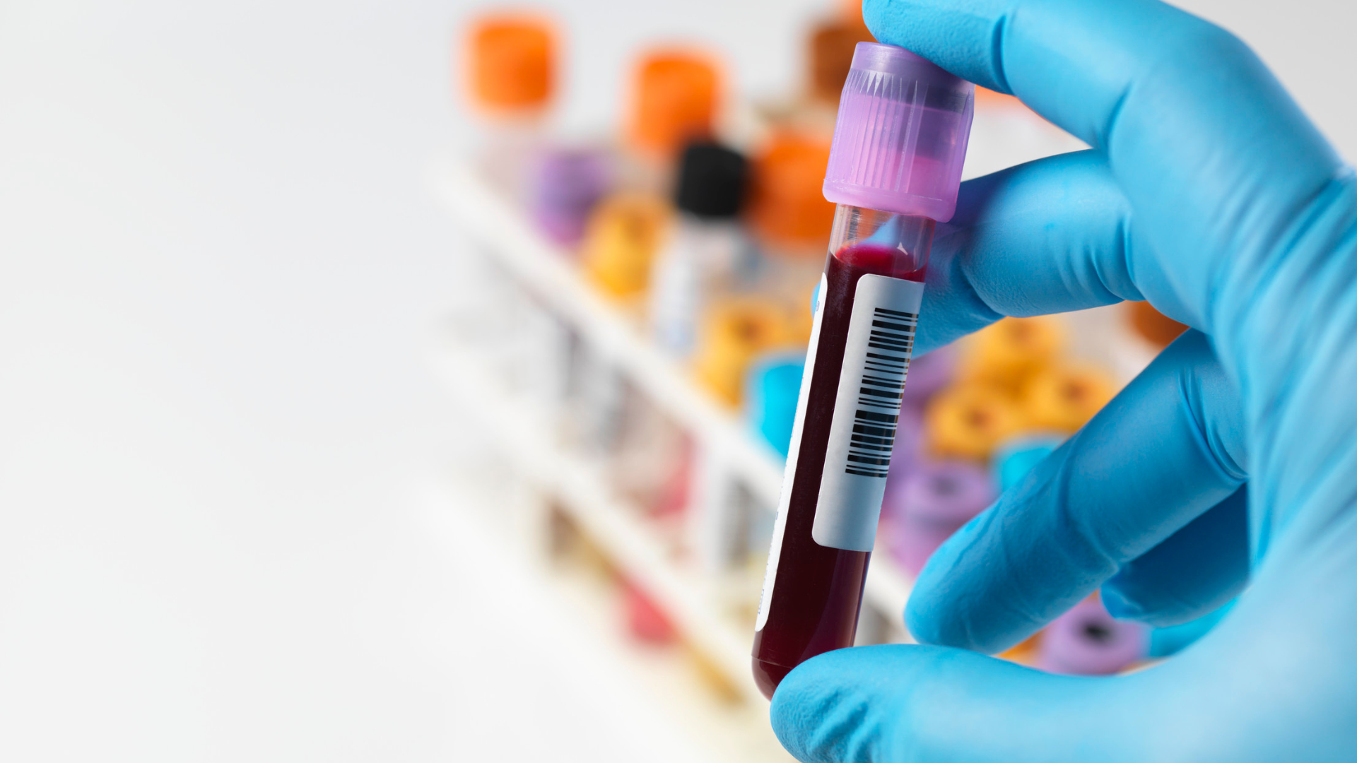Gloved hand holding a blood sample tube. Other tubes are in a rack. Bright, colorful tubes in a lab setting.