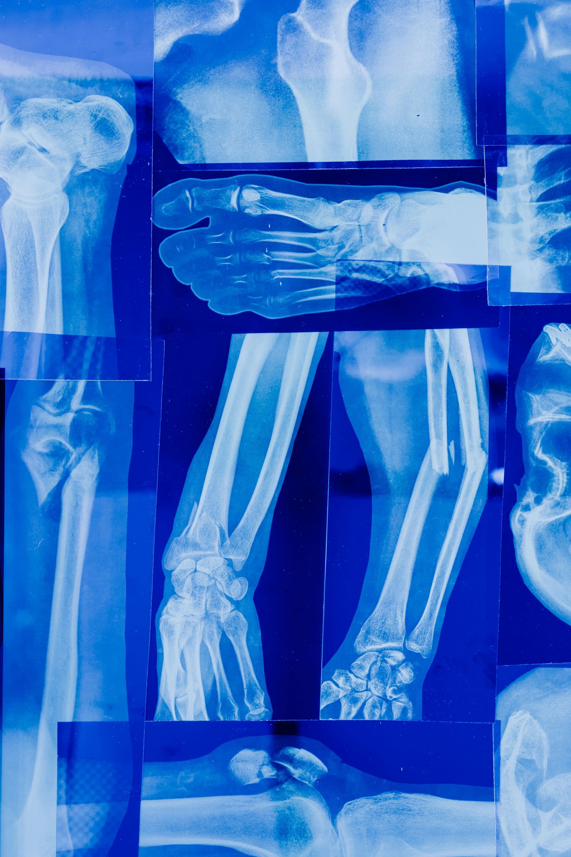 Medical X-ray images, various body parts, including arm, foot, and leg bones, displayed on a blue background.