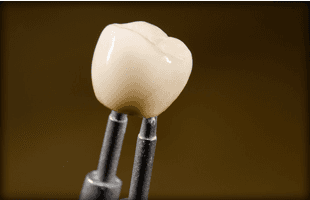 Close up of dental prosthetic