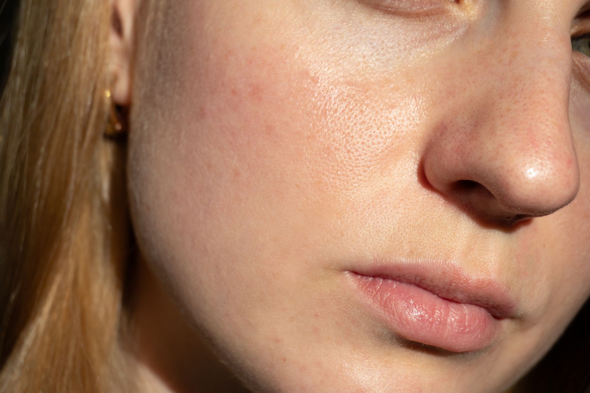 Close-up of a person's face with fair skin, slight blush, and shiny texture. Lips are pale pink.