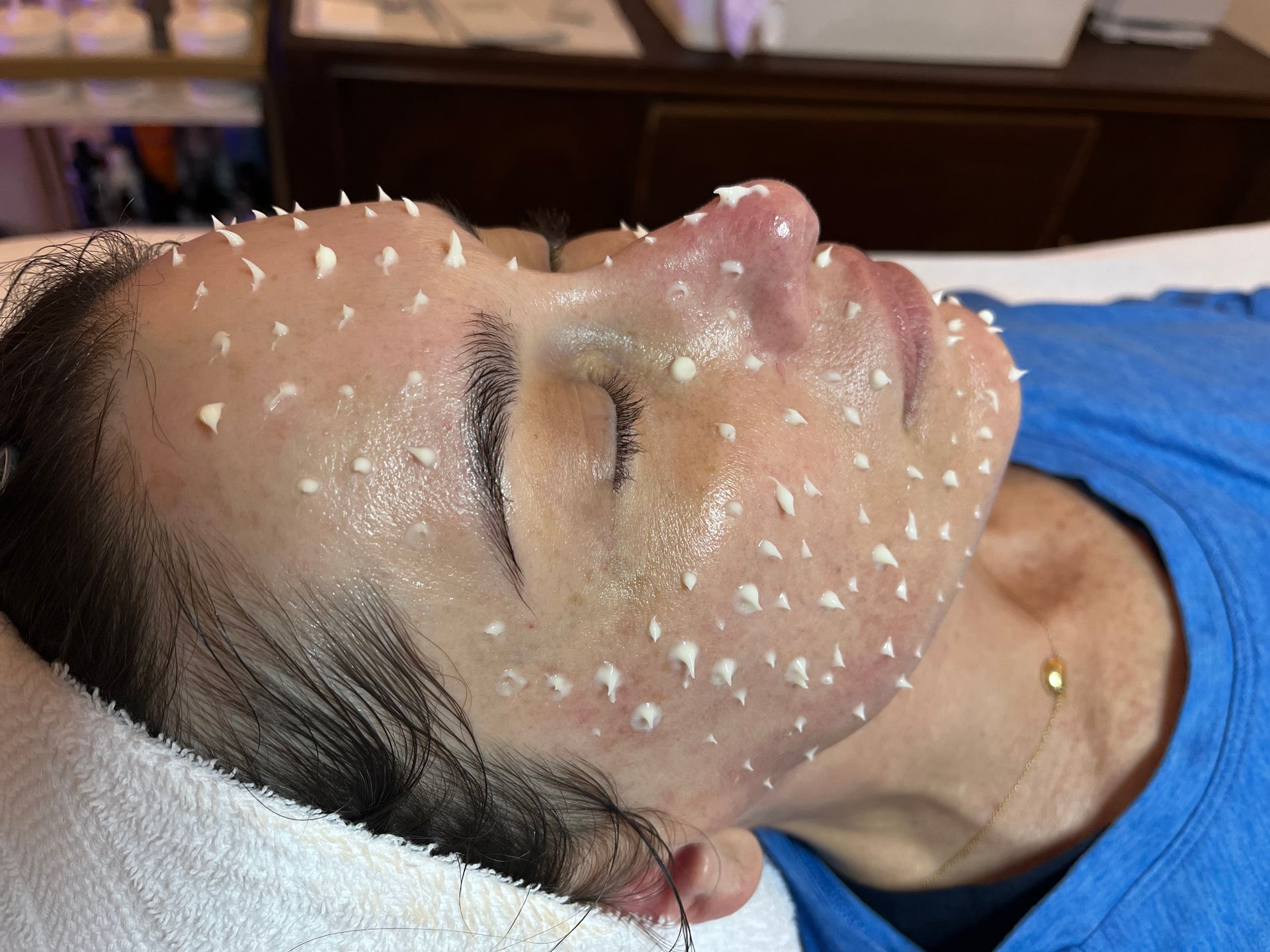 A woman is getting CellStory facial at a spa