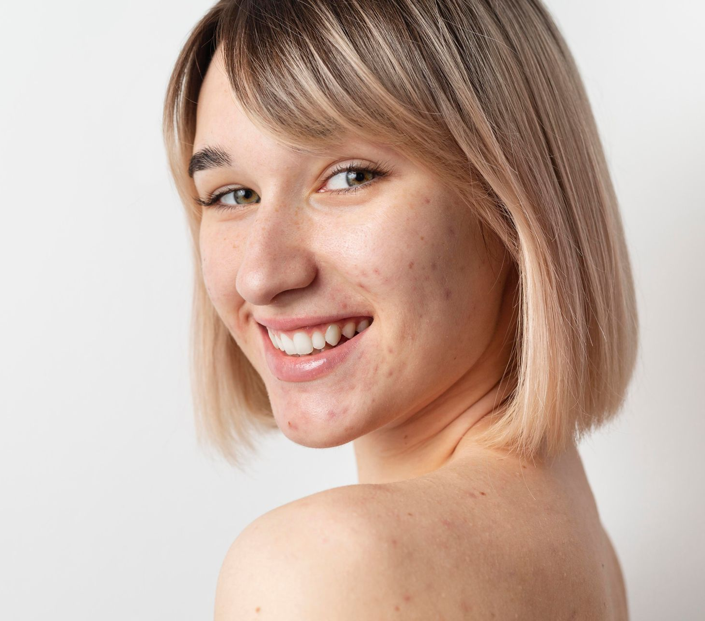A person with a white towel wrapped around their head touches a small blemish on their cheek against a beige background.