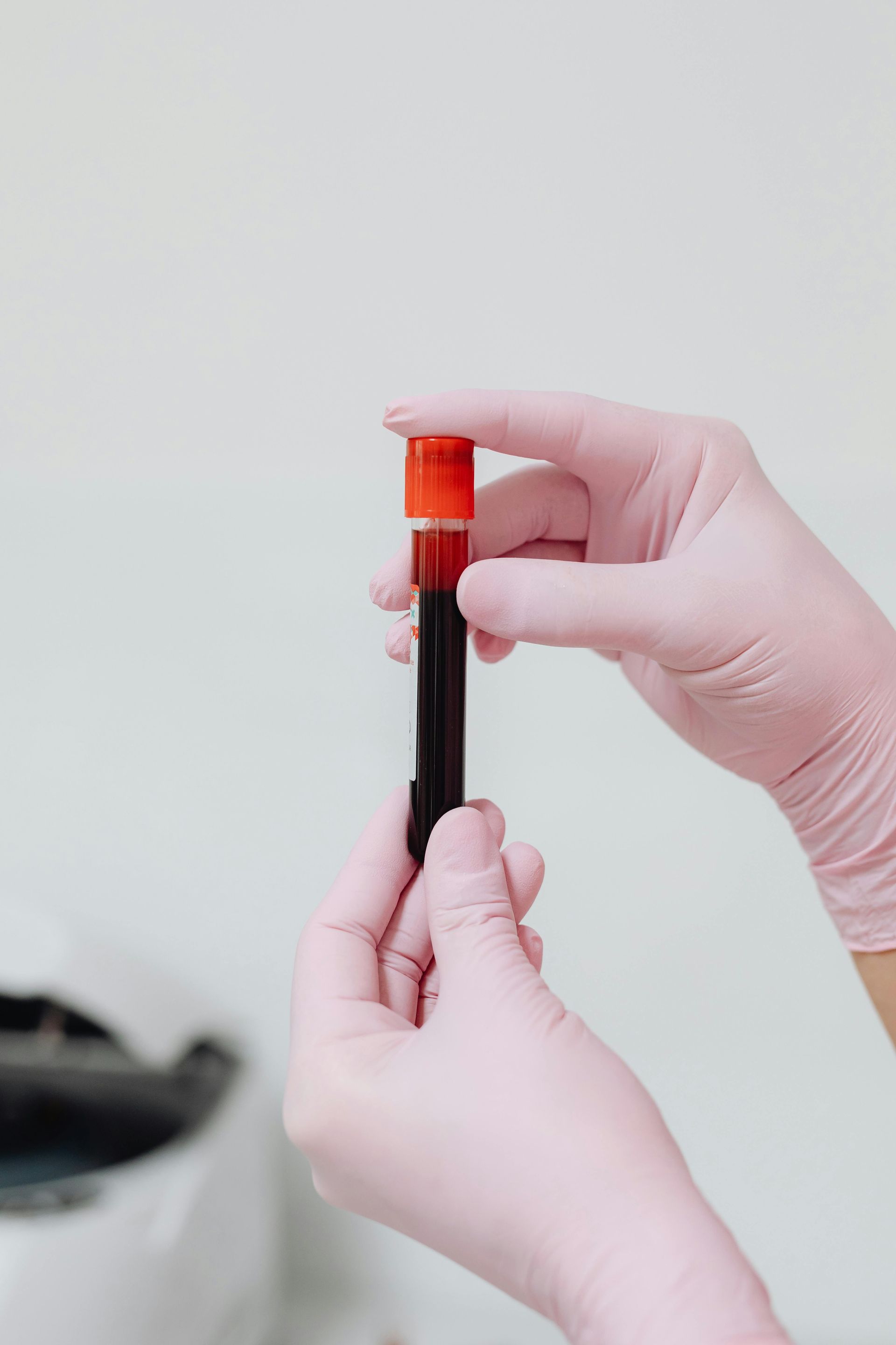 test vile of blood being held with two hands covered in latex medical gloves