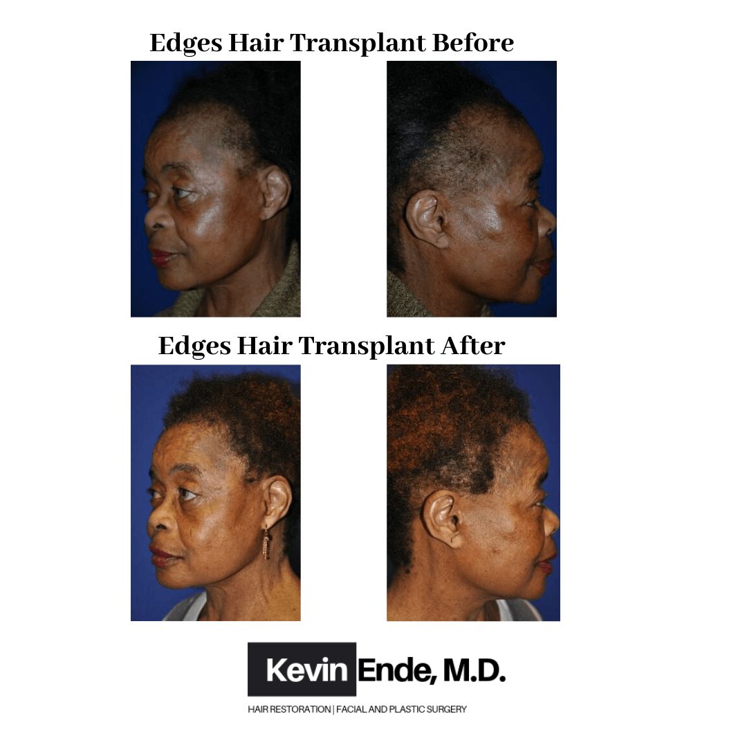 before and after images