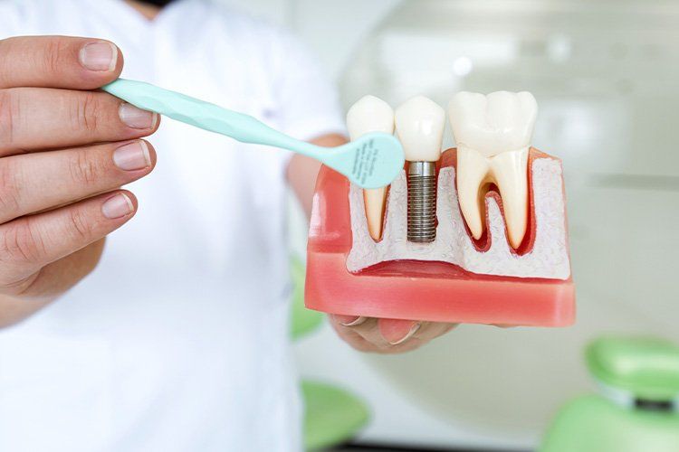 dentist presenting dental implant sculpture