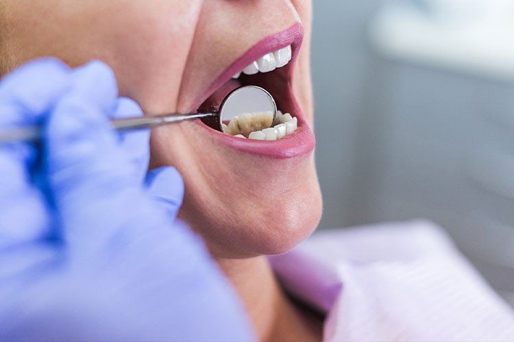 dentist inspecting patient teeth using small mirror