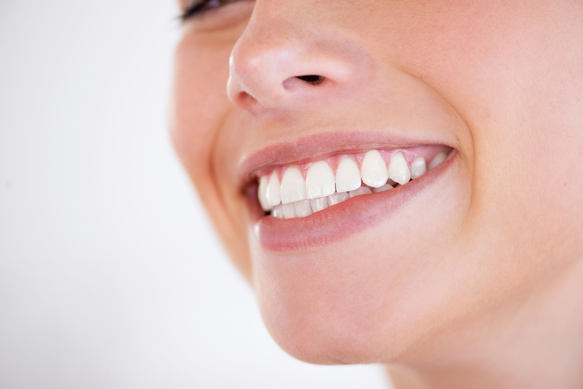 A close up of a woman 's smile with white teeth.