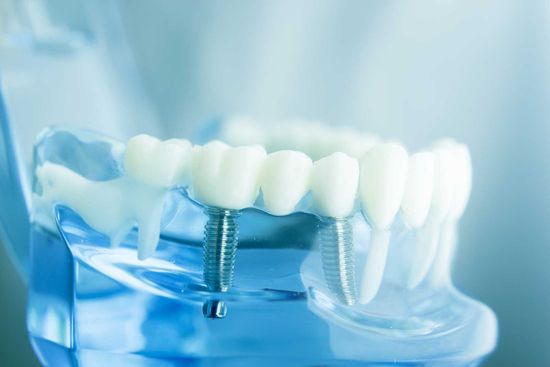 Dental tooth dentistry