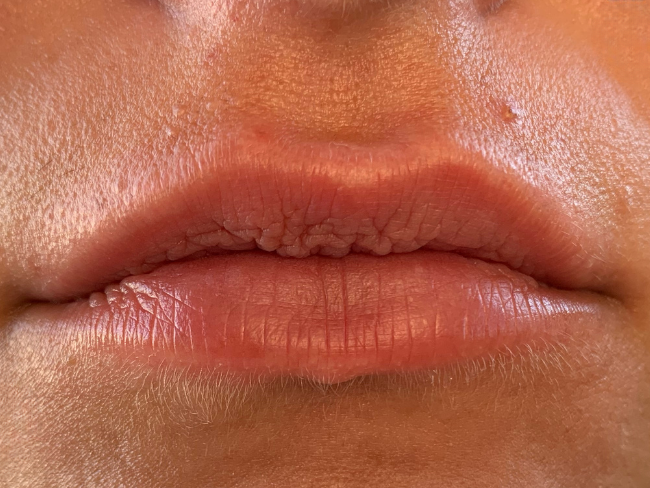 Close-up of a person's mouth and lips, showing natural skin texture and lip lines.
