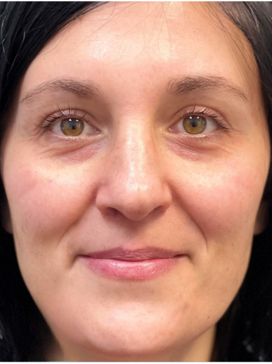 A close-up portrait of a person with dark hair, light skin, and hazel eyes, facing the camera with a gentle, neutral smile.