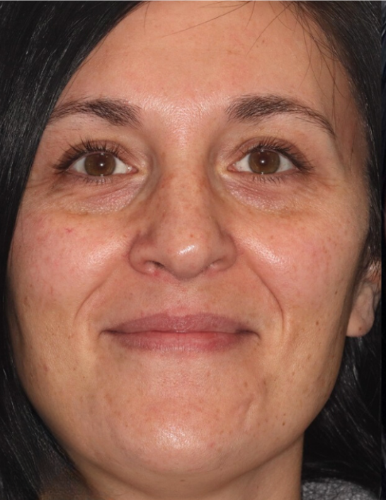 A close-up portrait of a person with dark hair, looking directly at the camera with a neutral expression.