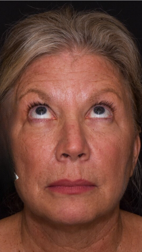 A portrait of a person looking upward, centered against a plain dark background, with a neutral expression.