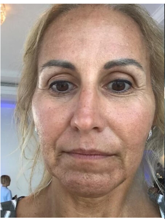 A close-up portrait of a person with blonde hair, looking toward the camera with a neutral expression in a bright room.