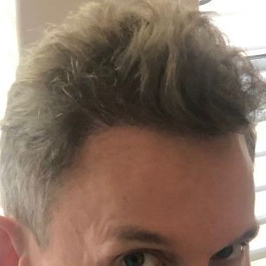 A close-up view of the top of a person's head, showing light brown, textured hair and the forehead.