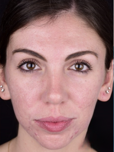 A close-up, front-facing portrait of a person showing