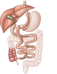 Diagram of a Roux-en-Y gastric bypass procedure. Digestive system with bypassed stomach and re-routed intestines.