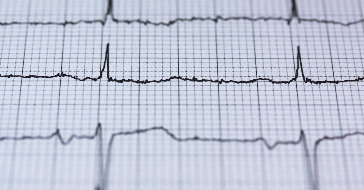 ECG waveform graph showing heart activity.