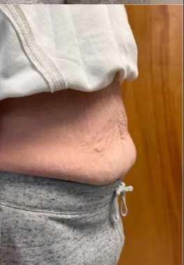 A close up of a person 's stomach with a white shirt and grey sweatpants.