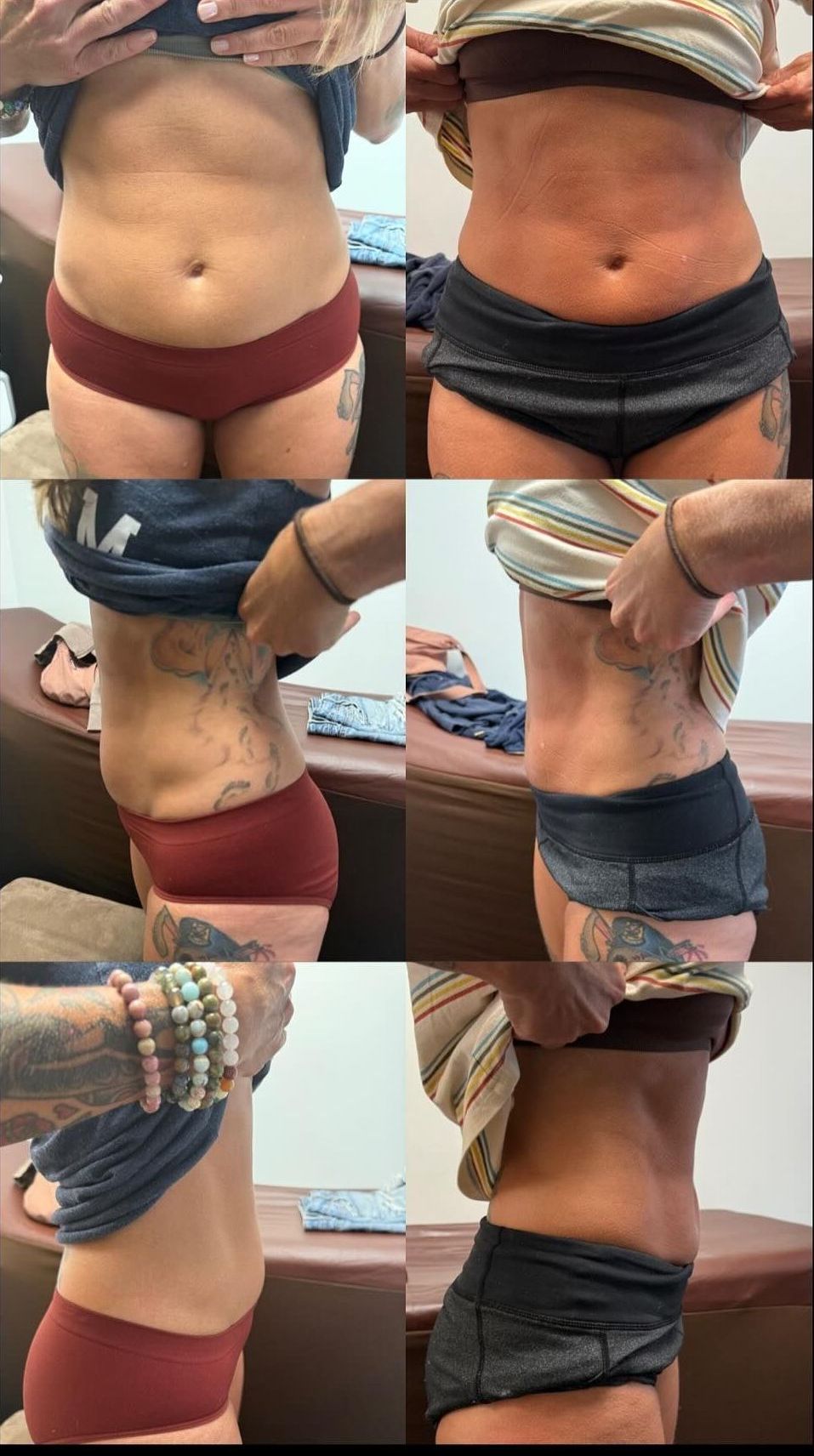 Woman showing results after EMS body sculpting