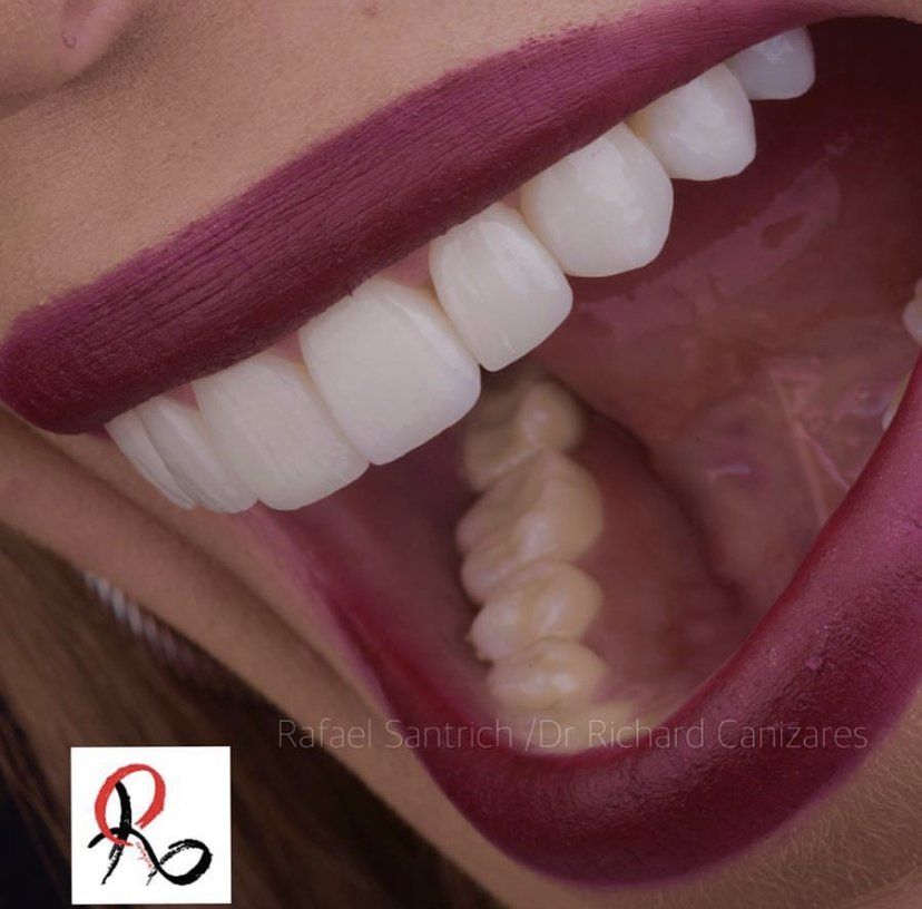 La mejor TECNOLOGÍA para el cuidado dental Dental Esthetic Solutions