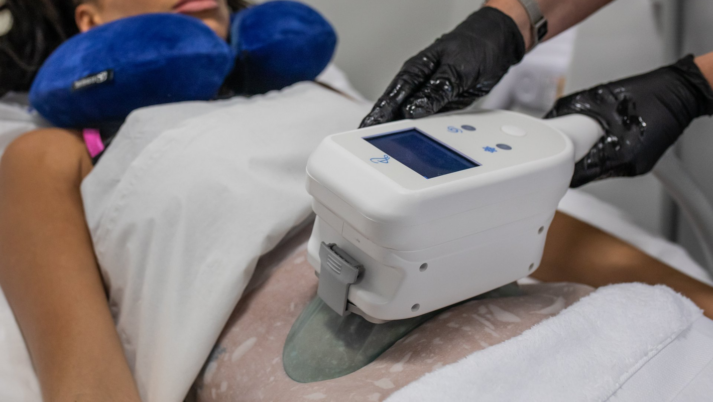 Cryolipolysis machine attached to person's stomach for treatment