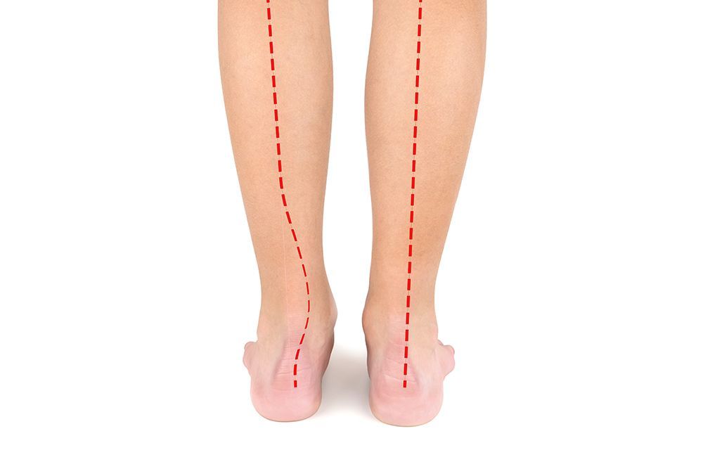 Deformity Correction