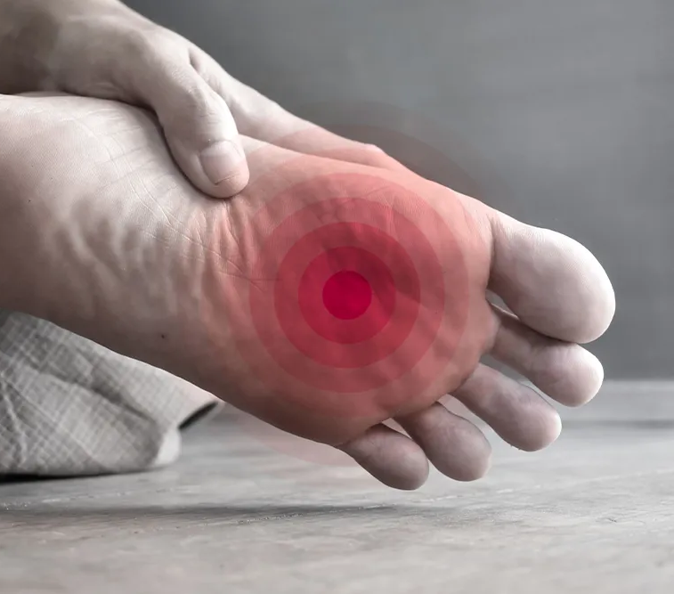 Foot Neuropathy
