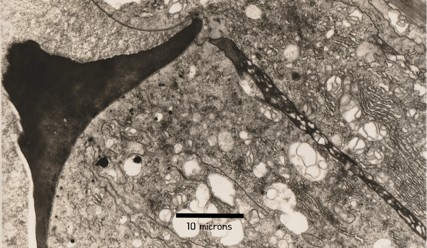 A black and white photo of a cell with a measurement of 1 microns