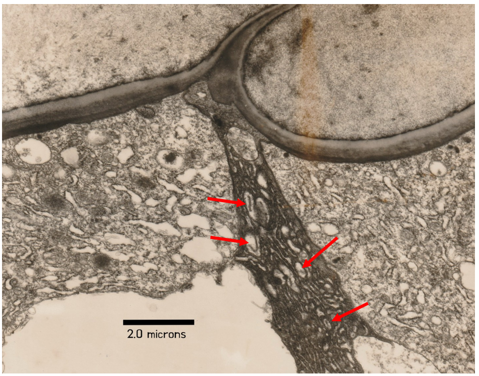 A black and white photo of a cell with a measurement of 1 microns