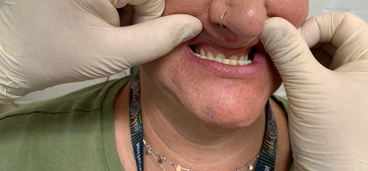 Kelly Frith Smiling — North Geelong, VIC — Shyne Dental & Denture Clinic