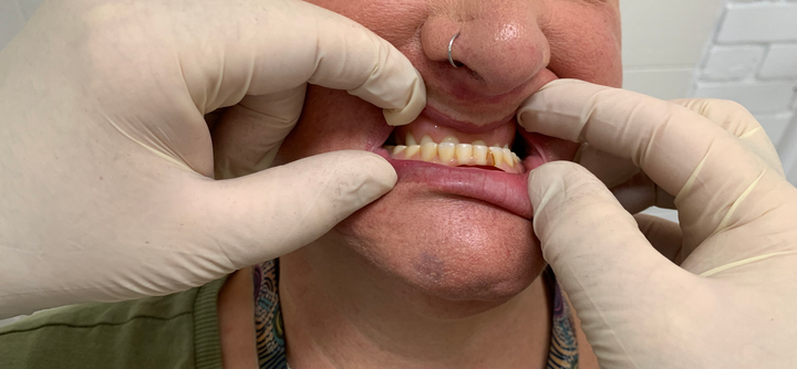 Kelly With Dentist Hand — North Geelong, VIC — Shyne Dental & Denture Clinic