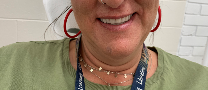 Kelly's Smiling With Her New Look Teeth — North Geelong, VIC — Shyne Dental & Denture Clinic