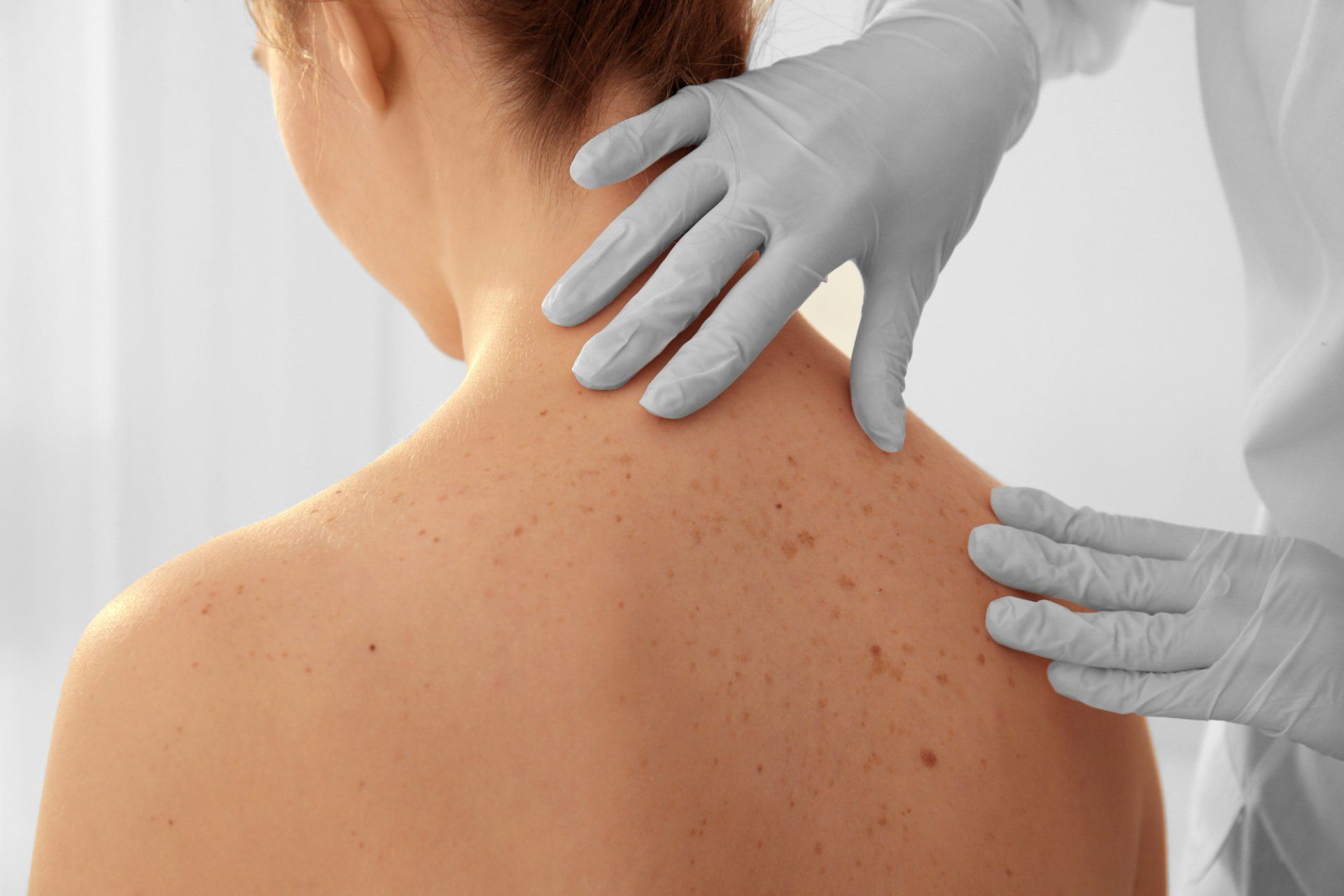 dermatologist examines patients back during skin exam
