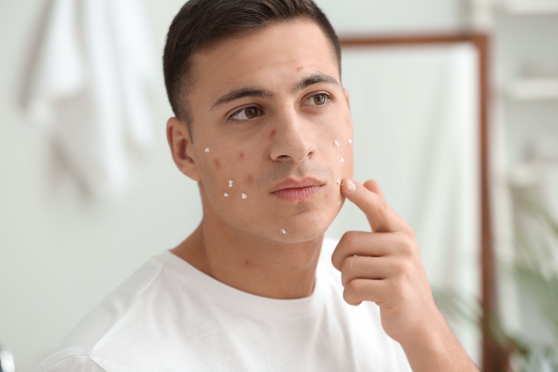 teen boy applying acne spot treatment