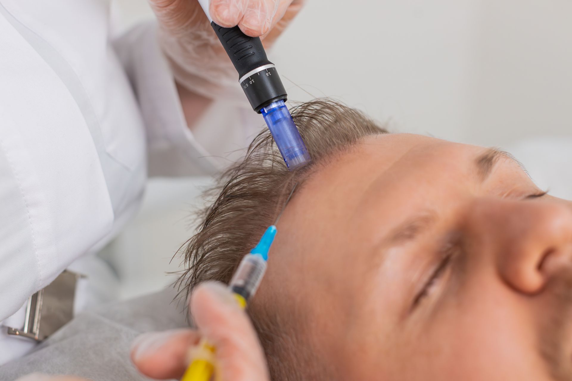 A man is getting a hair treatment in his head.