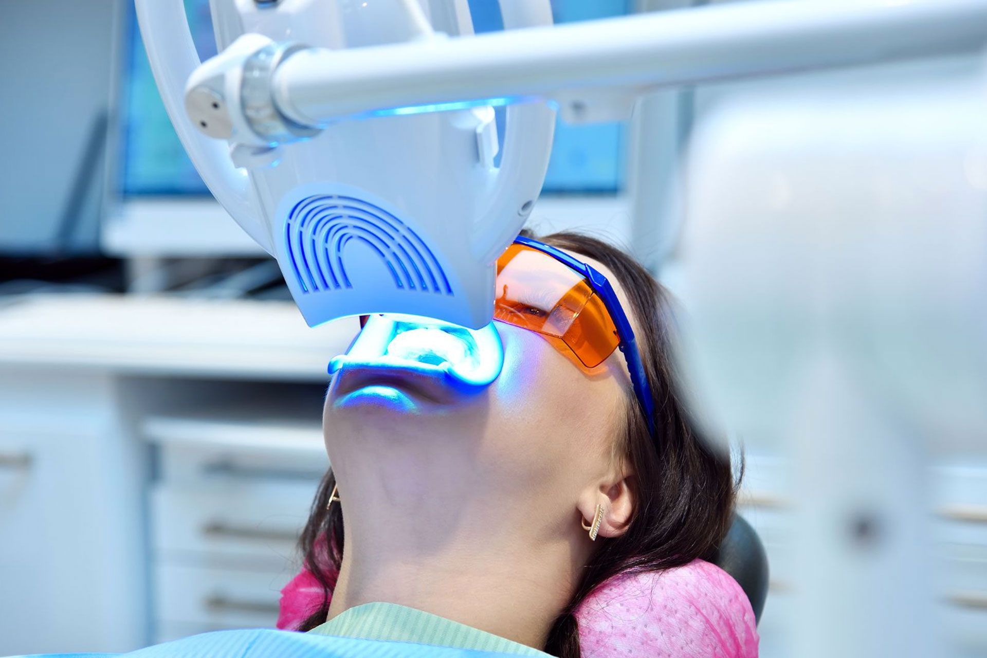 sbiancamento dentale