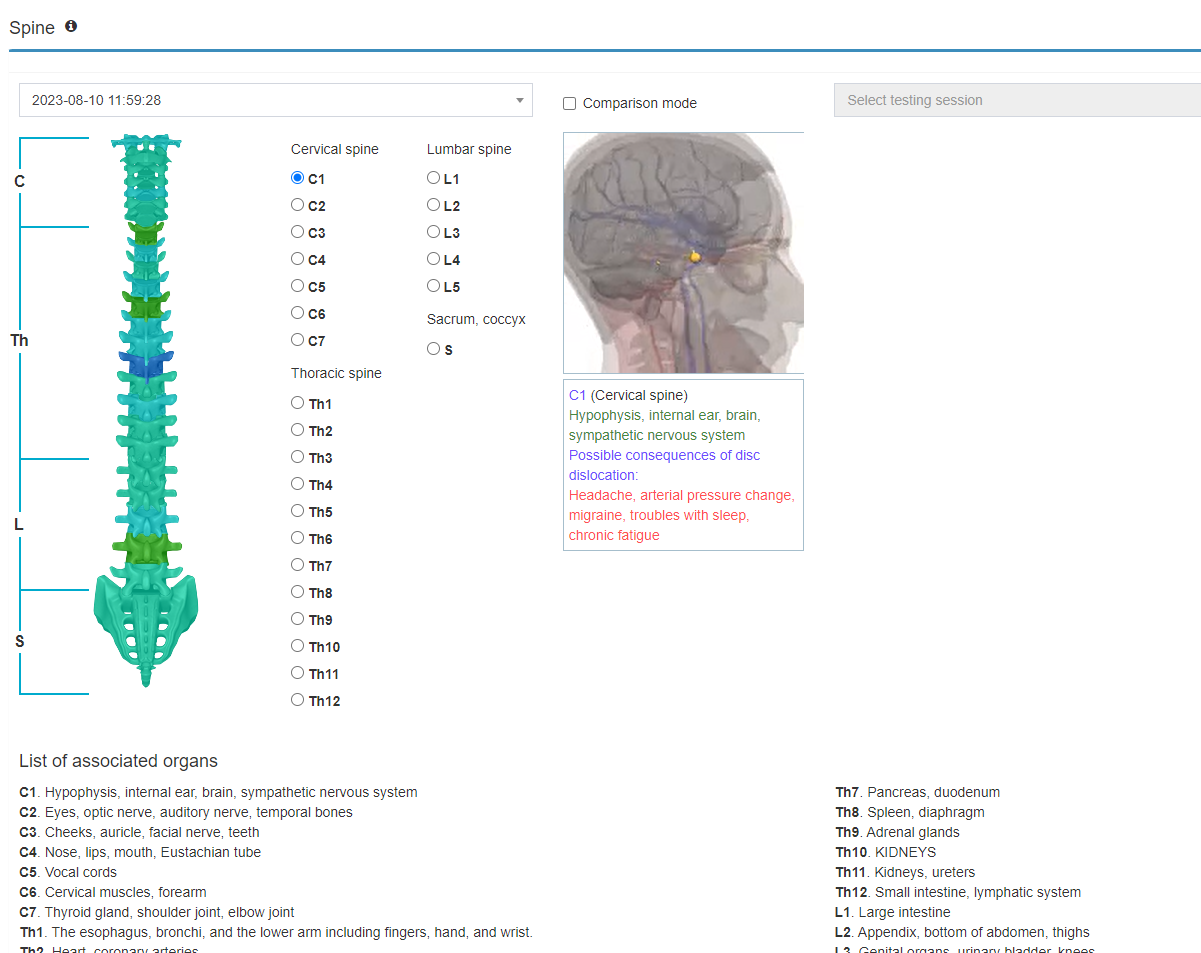 A computer screen shows a picture of a spine and a picture of a brain
