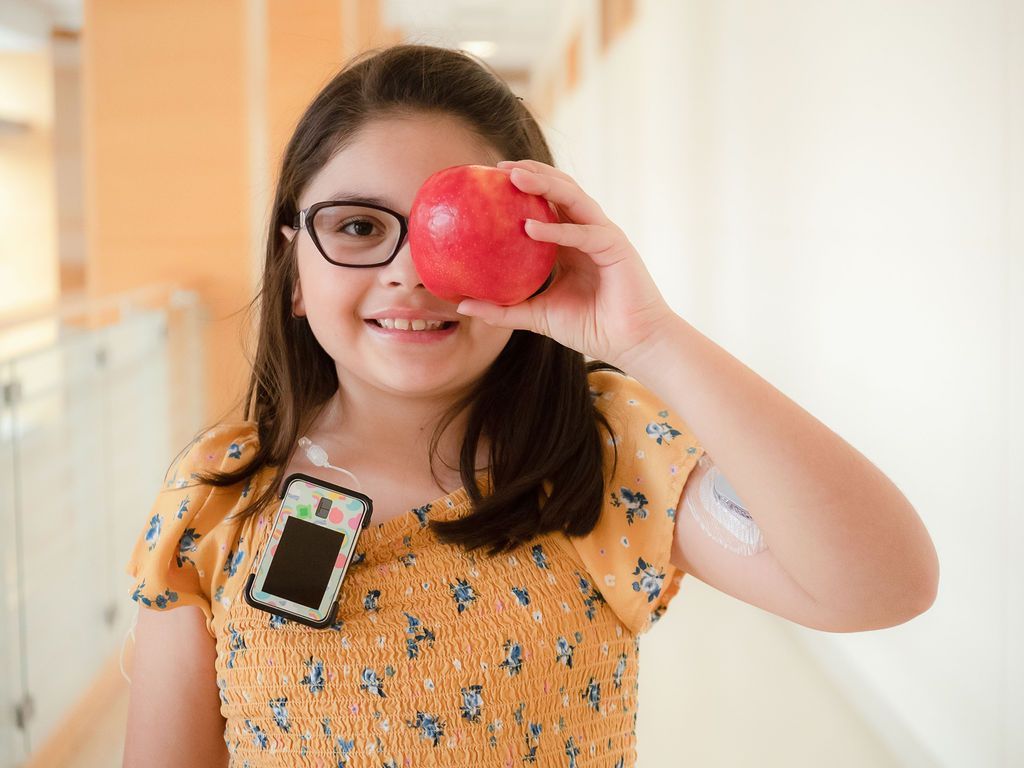 Young girl in glasses holding with an insulin pump, holding an apple in front of one eye.