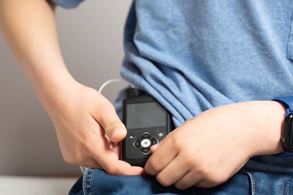 Close up of child using his insulin pump on his hip.
