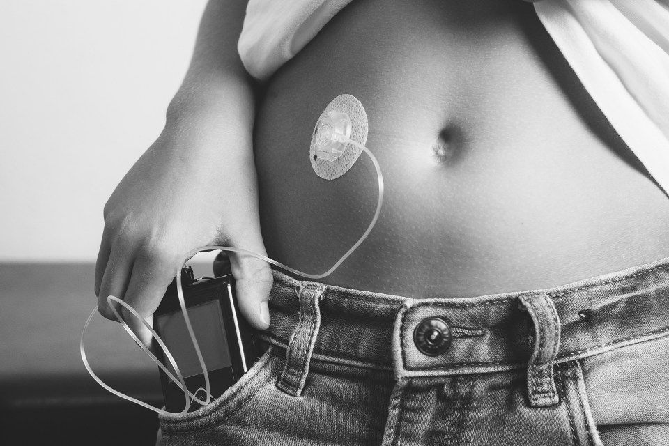 A black and white photo of a person 's stomach with a device attached to it.