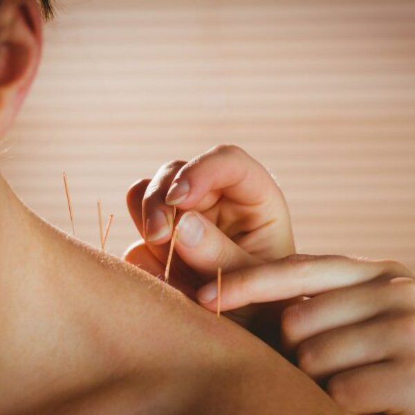 Modern Acupuncture Case Study on PR and Social Media