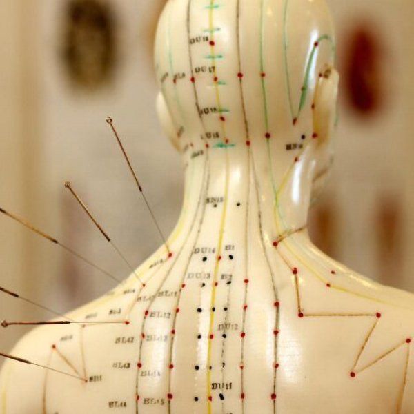 Modern Acupuncture Case Study