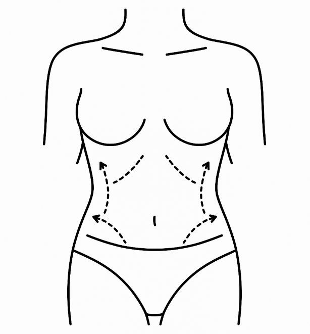 Outline of a torso with dotted arrows indicating fat removal procedures.