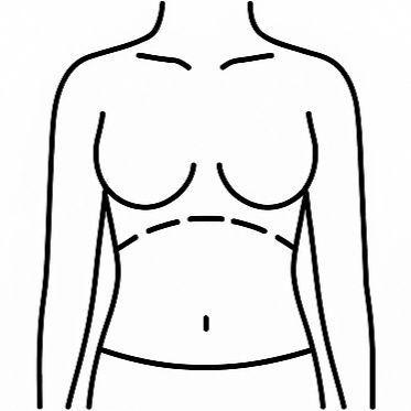 Outline of a torso with dashed lines indicating a surgical incision area.