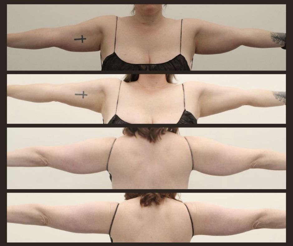 A woman with a tattoo of a cross on her arm