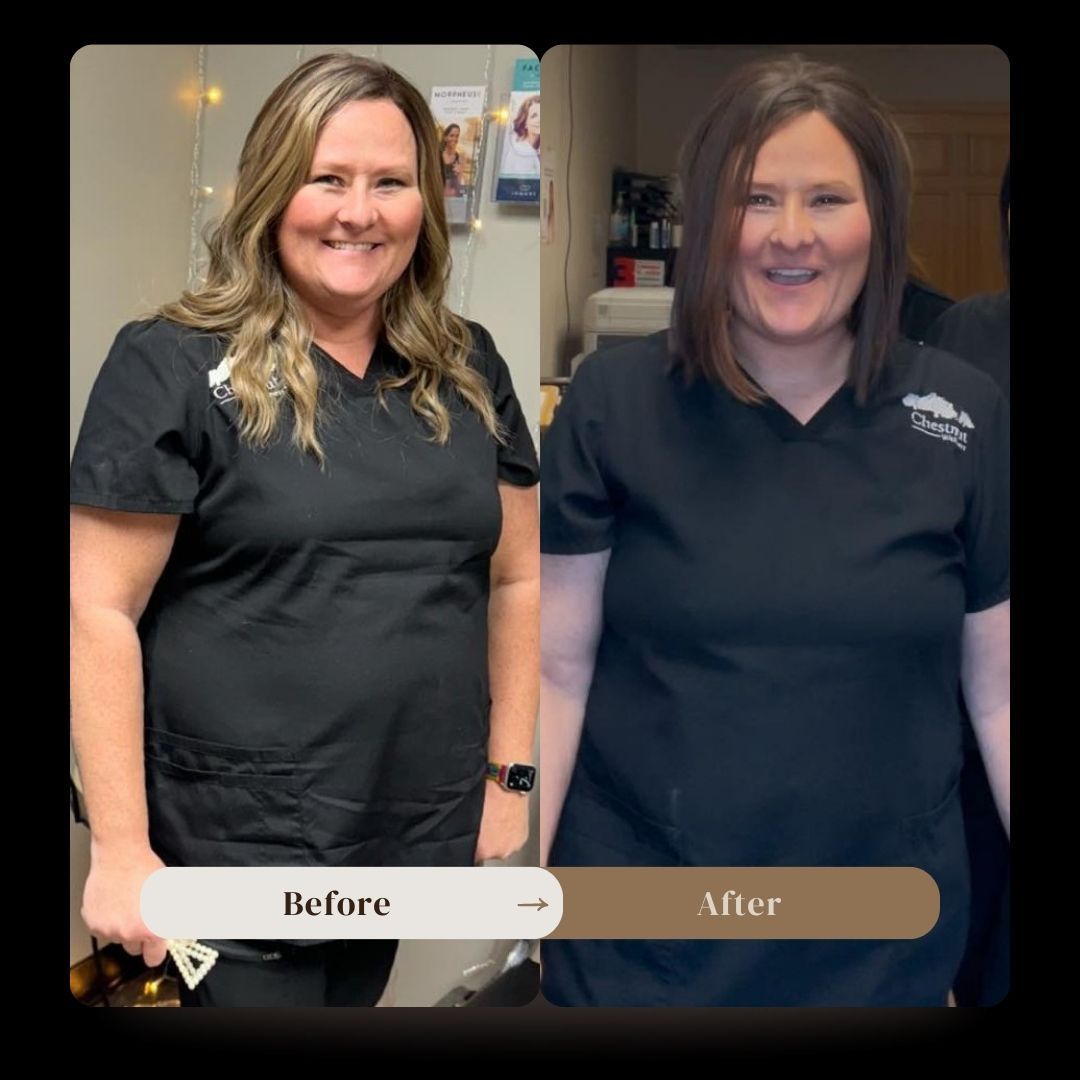 A before and after photo of a woman in scrubs