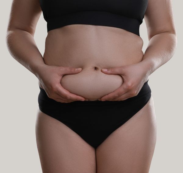 Woman in black underwear, holding stomach fat with hands, considering Lipo 360-3D.