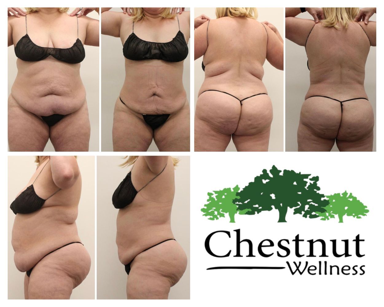A collage of photos of a woman with chestnut wellness written on the bottom