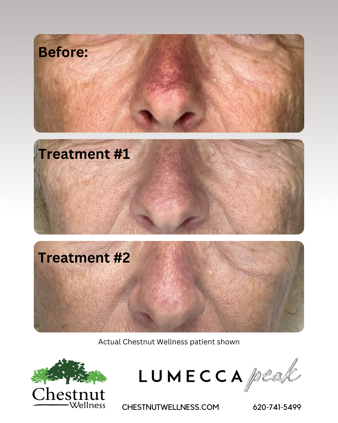 A before and after photo of a woman 's face